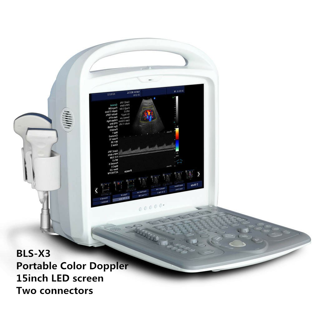 15' LED 3D 4D Laptop Ultrasonic Scanner portable ultrasound machine color doppler Systems